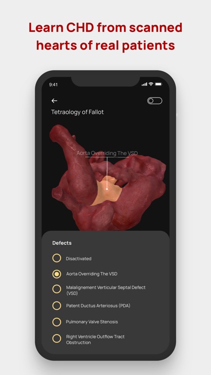 Congenital heARts screenshot-3