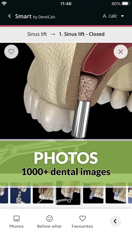 Dental Photos by DentiCalc