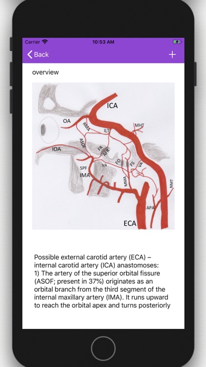 Vascular Variants screenshot-4