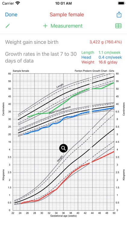 Preterm Growth Tracker