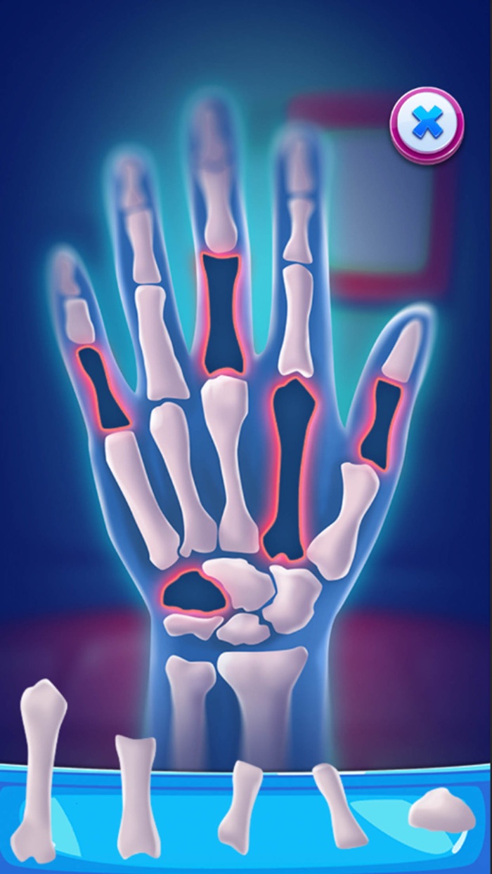 Hand Surgery - Healing Doctor