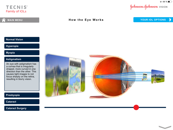 TECNIS® Vision Simulator