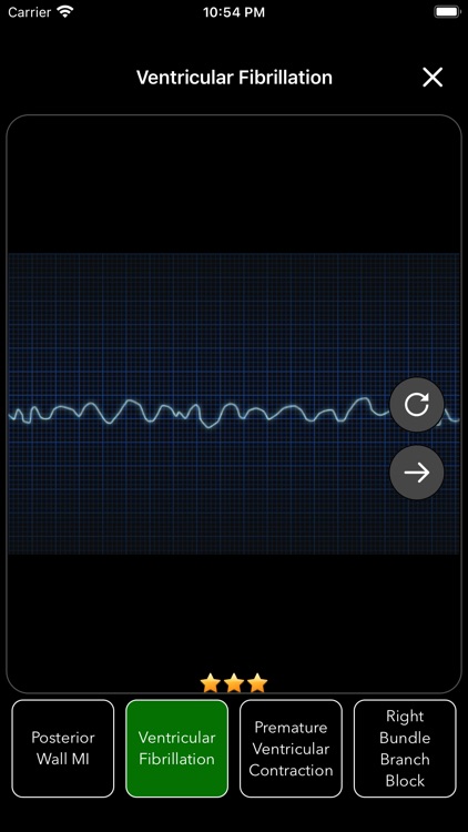 ECG Test Pro screenshot-0