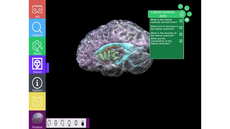 GreyMapp: Brain