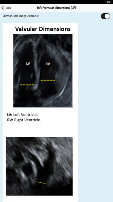 Fetal BCN Calculator screenshot 2