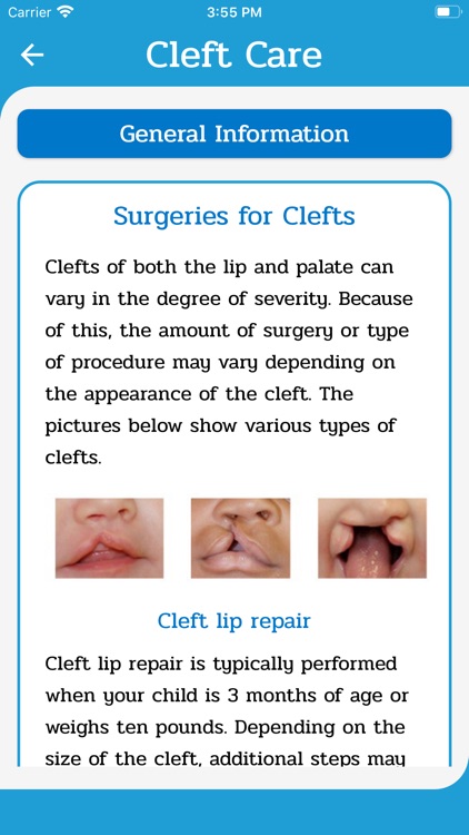 Cleft Care