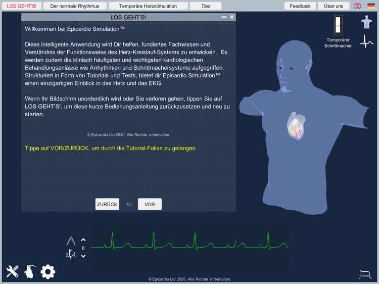 Temporary Cardiac Pacing screenshot-9