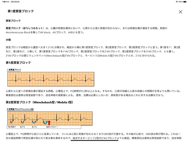 心電図ブック Ecg Ekg Books をapp Storeで