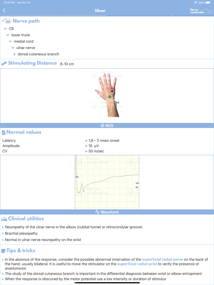 Nerve Conduction Studies