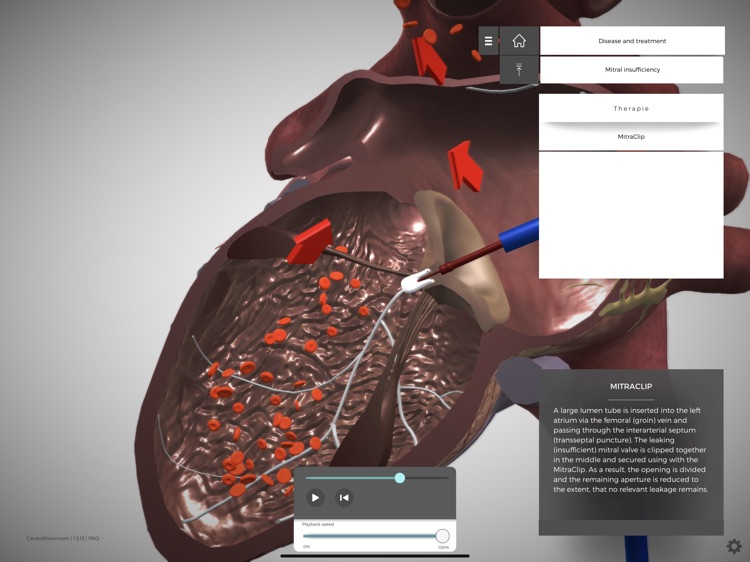 CardioShowroom (CSR) screenshot-9