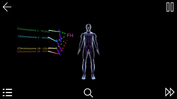 Familial Hypercholesterolemia