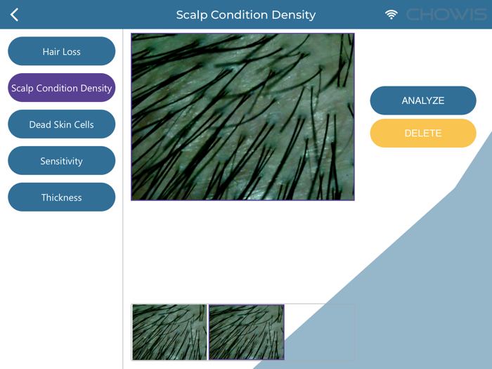 Chowis Hair Analyzer 2
