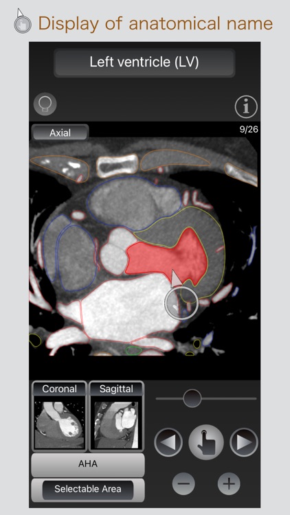 CT Passport Heart / MRI