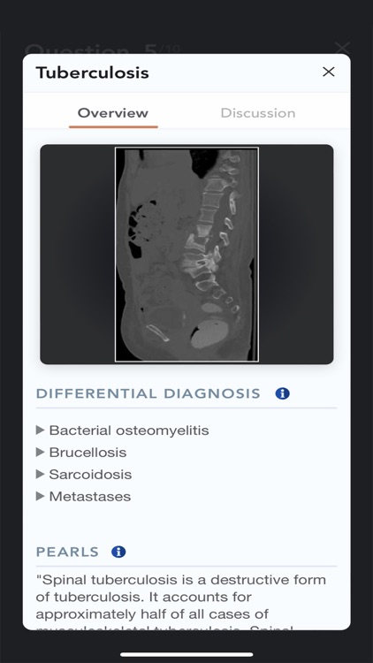 CTisus L-Spine Pathology screenshot-6