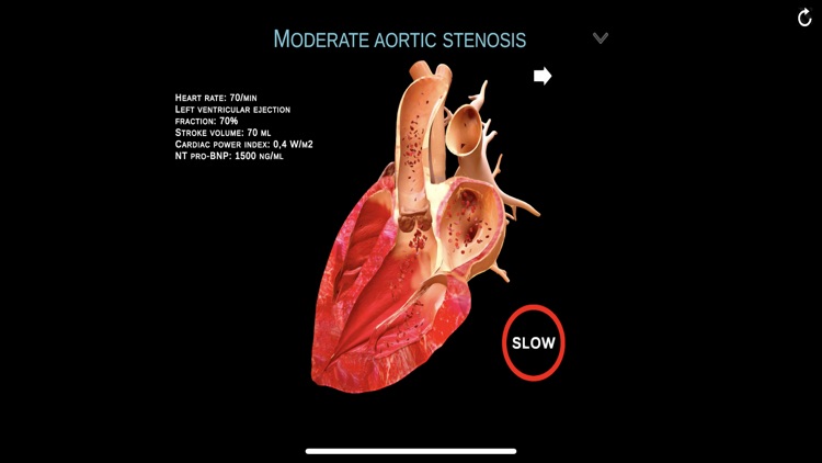 TheHeartPhysiologyApp screenshot-5
