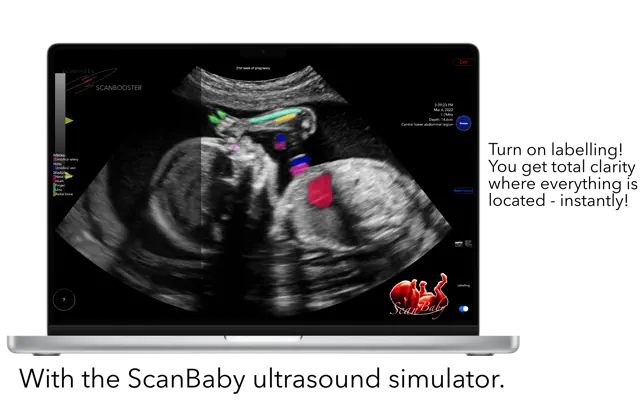 Screenshot 5 ScanBaby ultrasonido del bebé iphone