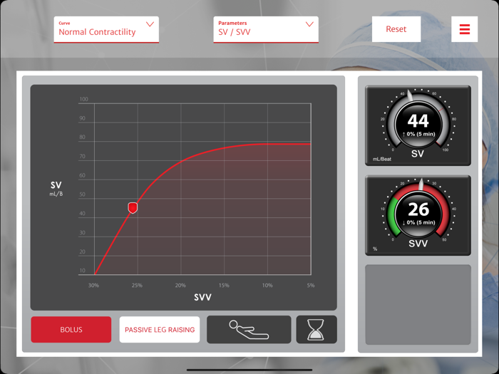 Fluid Response Simulator
