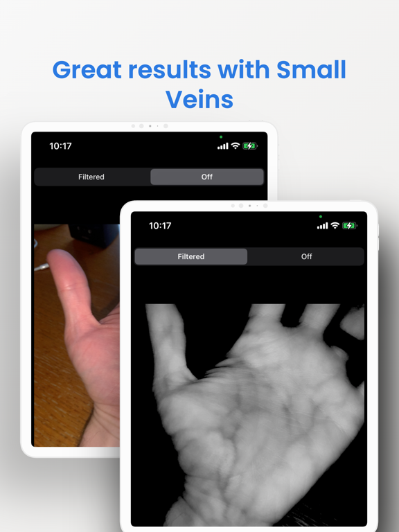 VeinSeek Pro VeinSeek Pro