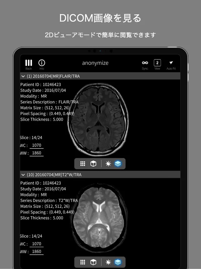 Captura 2 palm : DICOM & 3DModel Viewer iphone