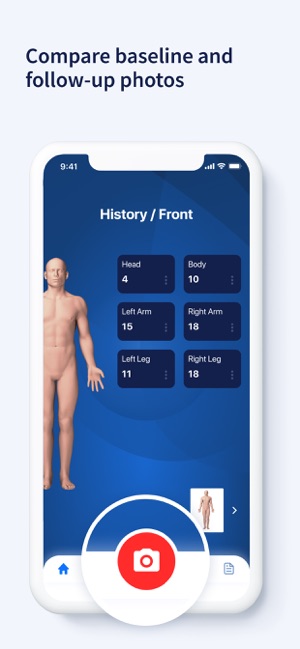 AI Dermatologist: Skin Scanner(圖5)-速報App