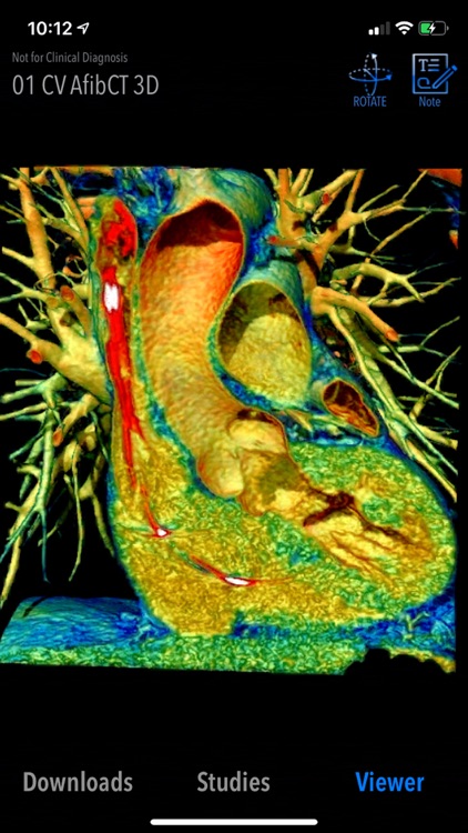 MedVizi™ CT-MRI Viewer