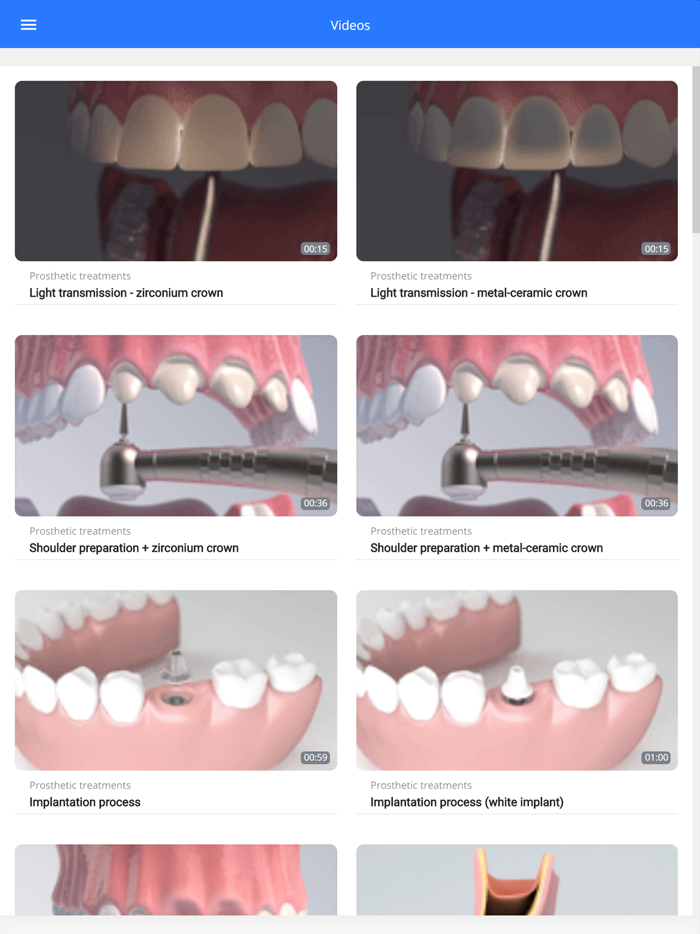 Dental videos by DentiCalc