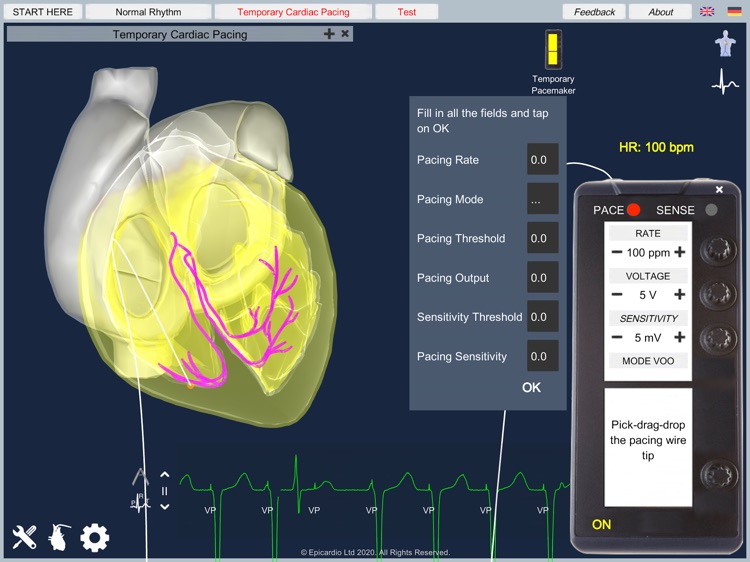 Temporary Cardiac Pacing screenshot-3