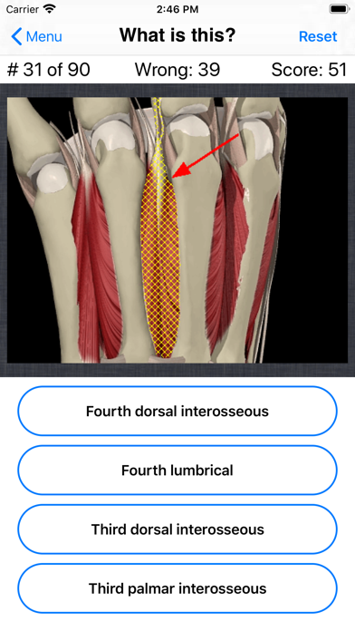 Anatomy Hand Quiz Screenshot 6