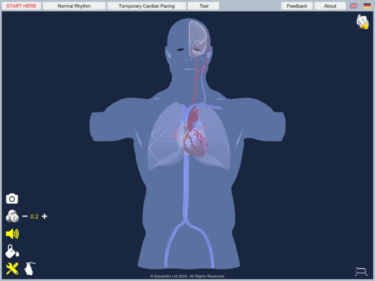 Temporary Cardiac Pacing screenshot-8