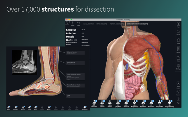 Complete Anatomy 21(圖2)-速報App