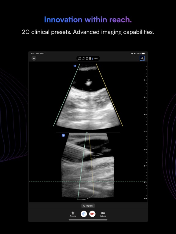 Butterfly iQ — Ultrasoundのおすすめ画像5