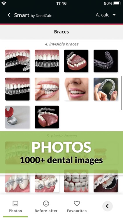 Dental Photos by DentiCalc