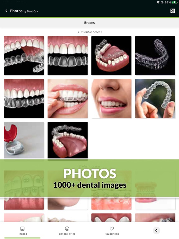 DentiCalc 4in1: Dental Care