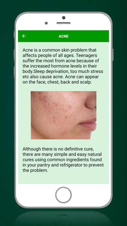 Aloe Vera Benefits ! screenshot-4