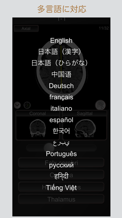 CT PassQuiz 腹部 / 断面図/... screenshot1