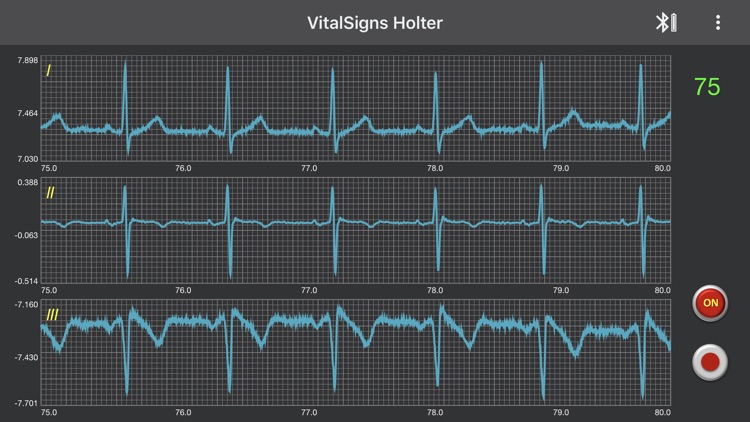 VitalSign Holter