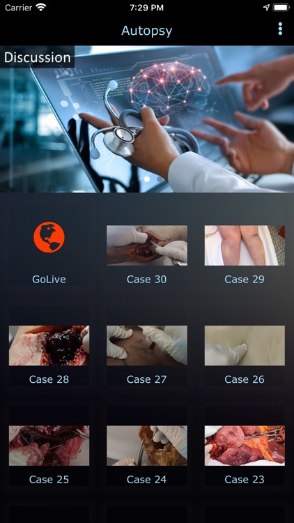 Autopsy
