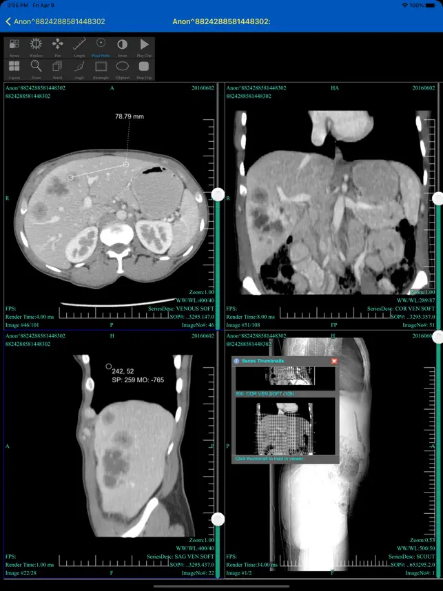 Imágen 6 dicom.link CloudPACS Client iphone