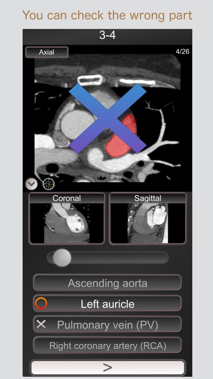 CT PassQuiz Heart / MRI