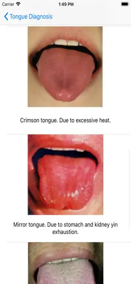 Game screenshot Tongue Diagnosis mod apk