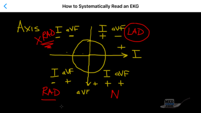 ECG / EKG Explained Clearlyのおすすめ画像5