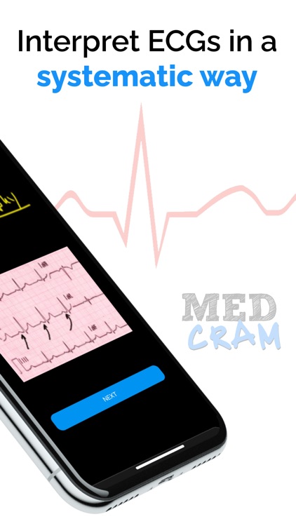 ECG / EKG Explained Clearly