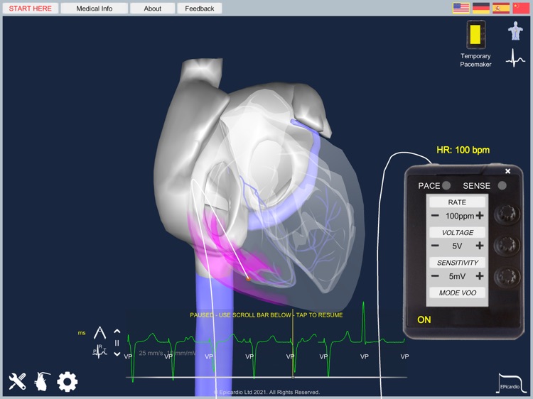 Epicardio Heart Simulator