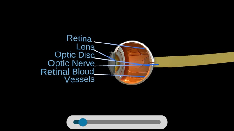 Anti-VEGF’s in DR, AMD & RVO