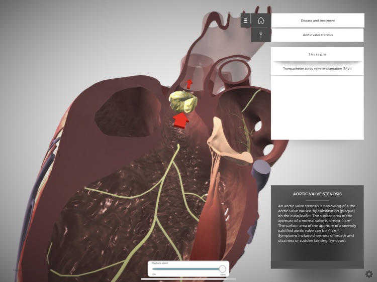 CardioShowroom (CSR) screenshot-6