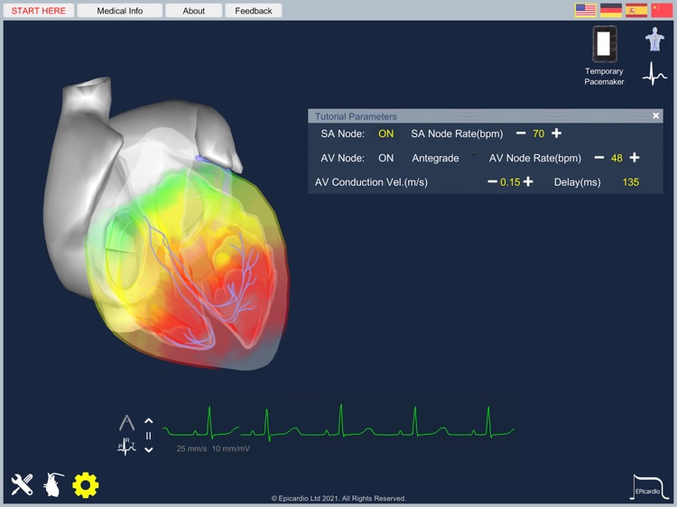 Epicardio Heart Simulator screenshot-5