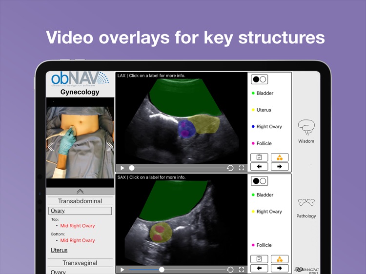 obNAV: Ultrasound Education