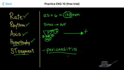 ECG / EKG Explained Clearlyのおすすめ画像3