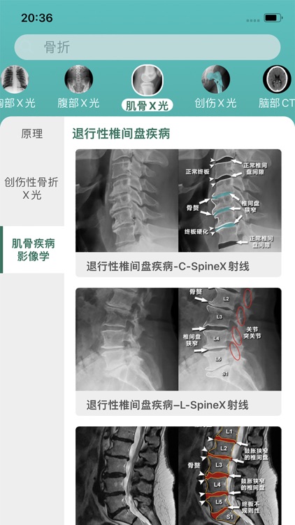 影像图谱