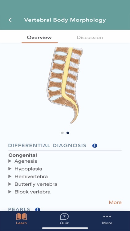 CTisus L-Spine Pathology